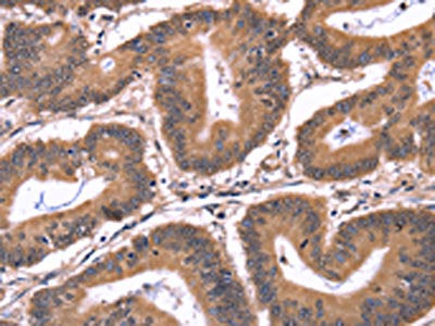 CRK Antibody