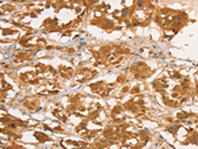 CPB1 Antibody