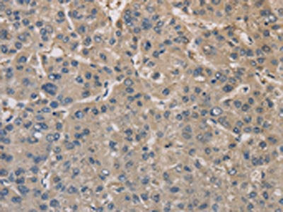 DPYSL3 Antibody