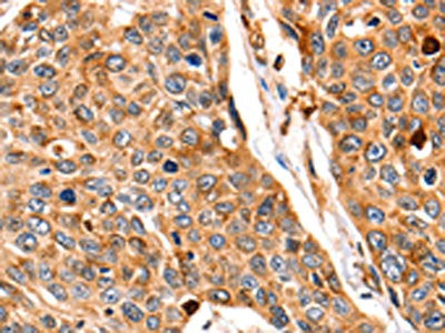 CTSB Antibody