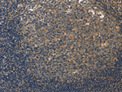 DUSP26 Antibody
