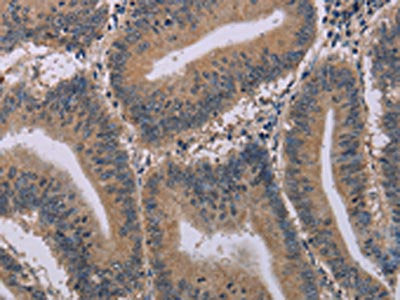 ACVR2A Antibody