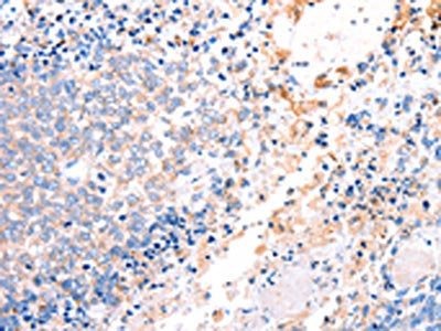 ACAD9 Antibody