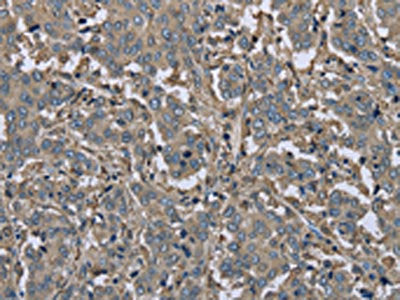 FBP1 Antibody