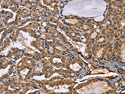 EPHB6 Antibody