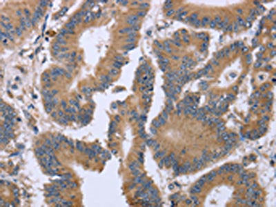 KIAA1324 Antibody