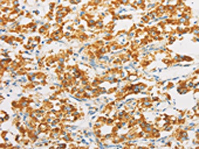 IDH3G Antibody