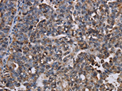 LBR Antibody