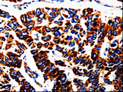 UTS2 Antibody