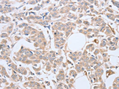 ABHD5 Antibody