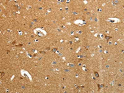 AMD1 Antibody