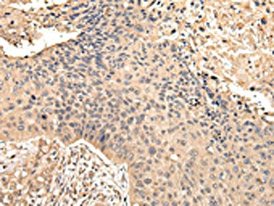 VPS35 Antibody