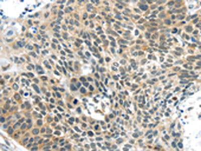 TSPY1 Antibody