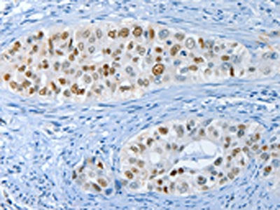 NEK4 Antibody
