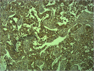 CDH1 Antibody