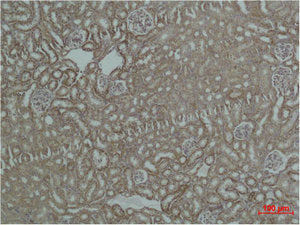 HSPD1 Antibody