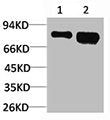 RPS6KB1 Antibody