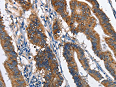 MAD2L1BP Antibody