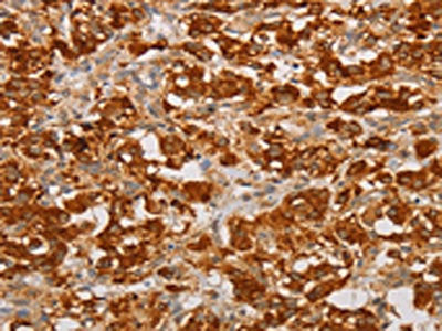 BNIP3 Antibody