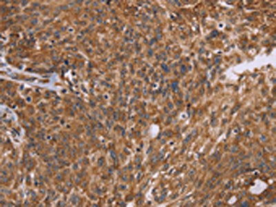 PPIB Antibody