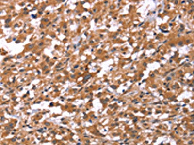 HSD17B1 Antibody