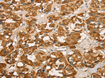 RBBP8 Antibody