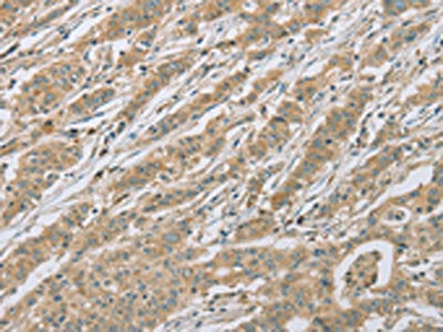 EEF2 Antibody