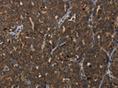 HOXC8 Antibody