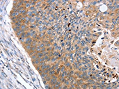 REG3A Antibody