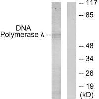 POLL Antibody