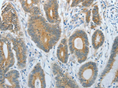 DNAJC3 Antibody