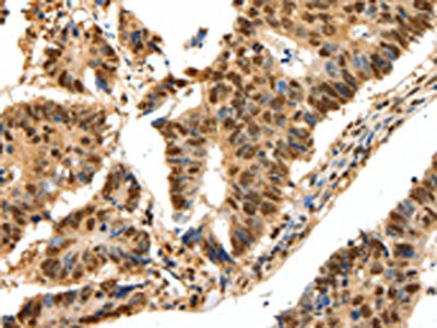 SSB Antibody