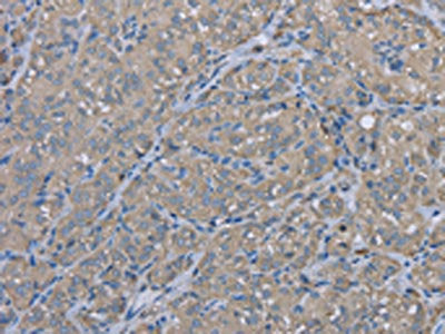 EZR Antibody
