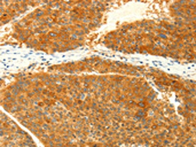 NAPA Antibody