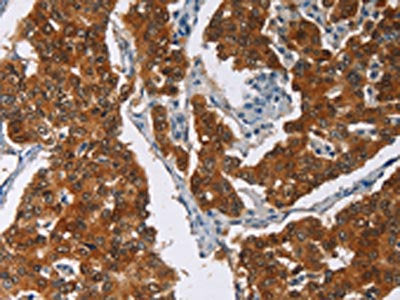 CRABP2 Antibody