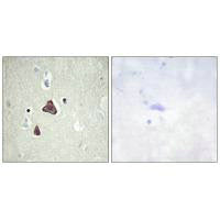 ADCY8 Antibody