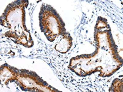 ARFGAP2 Antibody