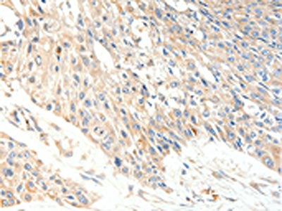 SLC27A1 Antibody