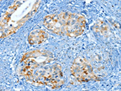 MUC15 Antibody