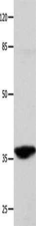 CTSG Antibody