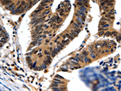 NEFL Antibody