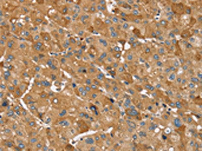 TRIM34 Antibody