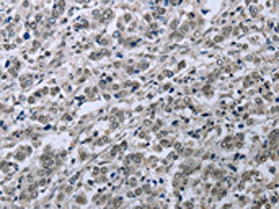 FES Antibody