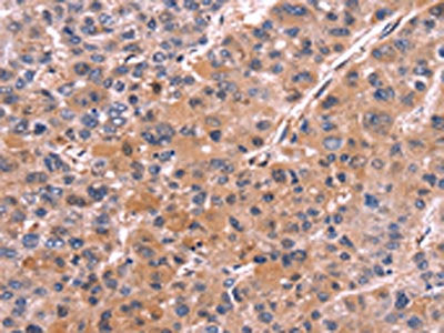 COL20A1 Antibody