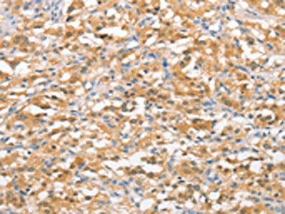 UBQLN1 Antibody