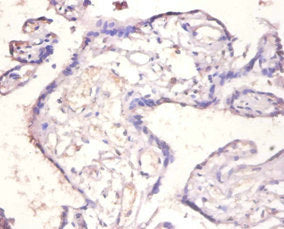 IL18BP Antibody