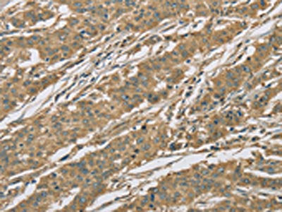 EIF3F Antibody