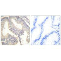 GAST Antibody