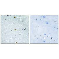 ZFHX3 Antibody