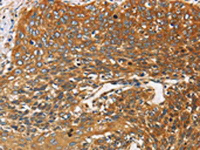 DCTN2 Antibody